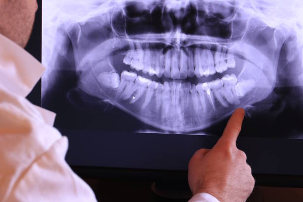 Best Emergency Dental Care for Broken or Chipped Teeth in Evans, CO