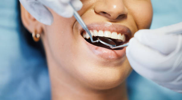 Best Emergency Tooth Extraction in Evans, CO