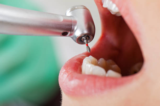 Best Emergency TMJ Treatment in Evans, CO